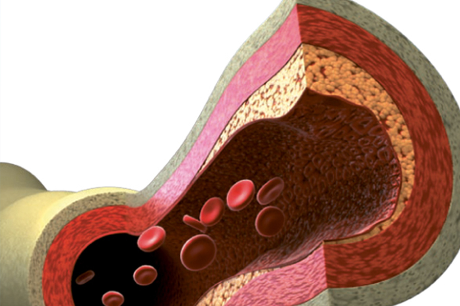arteries